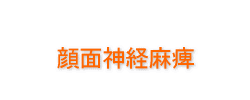 顔面神経麻痺１